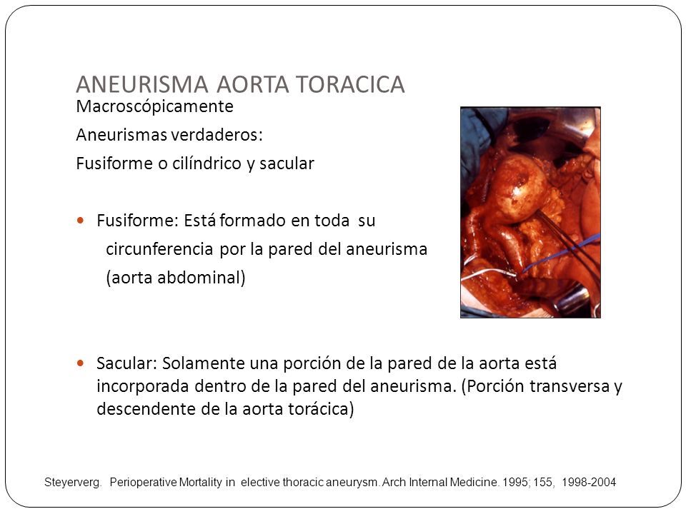 Duelen los riñones a los hombres el tratamiento